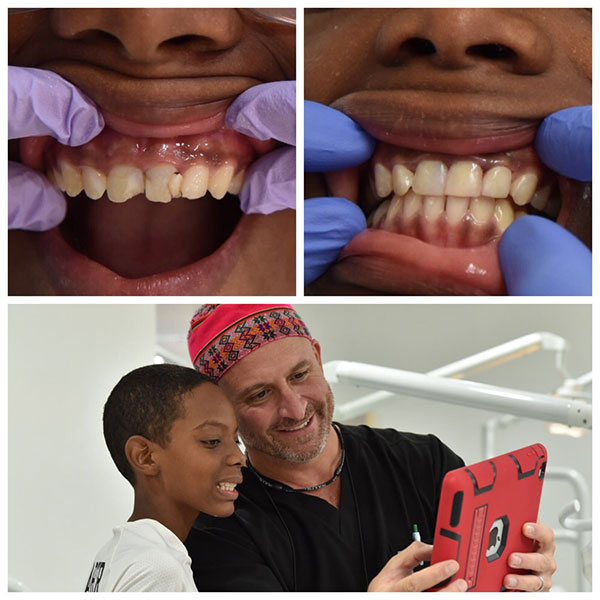 First-State-Dental-Operation-Smile-2017-2