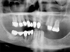 Wilmington Dentist - Dental X-ray