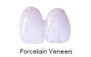 dental porcelain veneers, specimen