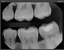Dental  Imaging